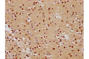 IHC image of ABIN7139839 diluted at 1:500 and staining in paraffin-embedded human brain tissue performed on a Leica BondTM system.