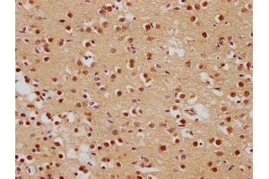 IHC image of ABIN7139839 diluted at 1:500 and staining in paraffin-embedded human brain tissue performed on a Leica BondTM system. (Foxo6 anticorps  (AA 211-218))