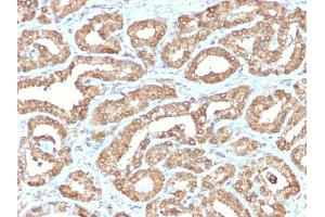 Formalin-fixed, paraffin-embedded human Prostate stained with ODC1 Rabbit Recombinant Monoclonal Antibody (ODC1/2878R). (Recombinant ODC1 anticorps)