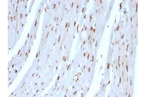 Formalin-fixed, paraffin-embedded Rat Heart stained with SUMO-2 MAb (SUMO2/1199)