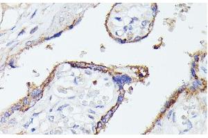 Immunohistochemistry of paraffin-embedded Human placenta using LTF Polyclonal Antibody at dilution of 1:100 (40x lens). (Lactoferrin anticorps)