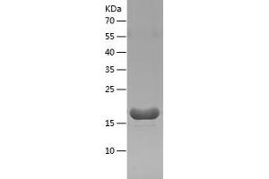 Western Blotting (WB) image for Interferon gamma (IFNG) (AA 23-155) (Active) protein (His tag) (ABIN7123488)