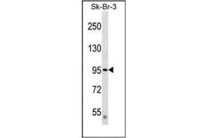 Western blot analysis of DTX3L / BBAP Antibody  in SK-BR-3 cell line lysates (35ug/lane). (DTX3L anticorps  (Middle Region))