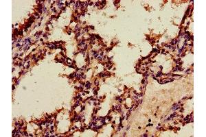 Immunohistochemistry of paraffin-embedded human lung tissue using ABIN7144268 at dilution of 1:100