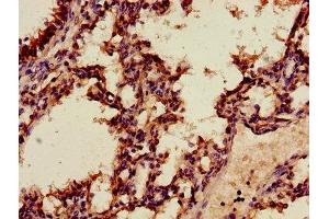 Immunohistochemistry of paraffin-embedded human lung tissue using ABIN7144268 at dilution of 1:100 (Annexin A2 anticorps  (AA 2-339))