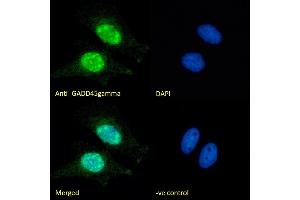 (ABIN334406) Immunofluorescence analysis of paraformaldehyde fixed HeLa cells, permeabilized with 0. (GADD45G anticorps  (Internal Region))