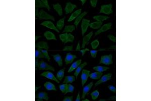 Immunofluorescence analysis of L929 cells using COX15 Polyclonal Antibody (ABIN7266634) at dilution of 1:100 (40x lens).