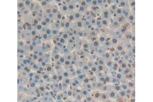 Used in DAB staining on fromalin fixed paraffin- embedded liver tissue