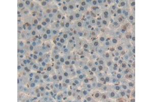 Used in DAB staining on fromalin fixed paraffin- embedded liver tissue (DKC1 anticorps  (AA 298-509))