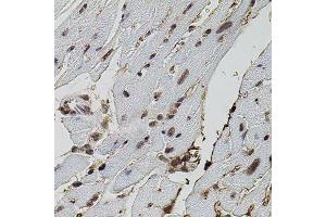 Immunohistochemistry of paraffin-embedded mouse heart using EIF4G2 antibody.
