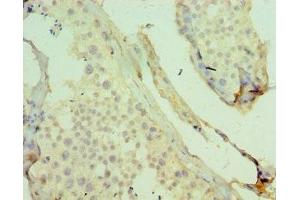 Immunohistochemistry of paraffin-embedded human testis tissue using ABIN7158699 at dilution of 1:100 (KDM4B anticorps  (AA 1-260))