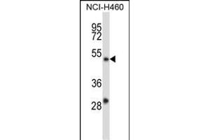 YY2 Antibody (C-term) (ABIN657589 and ABIN2846590) western blot analysis in NCI- cell line lysates (35 μg/lane). (YY2 anticorps  (C-Term))