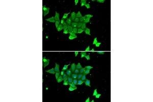 Immunofluorescence (IF) image for anti-phosphohistidine Phosphatase 1 (PHPT1) (AA 1-125) antibody (ABIN3021489)
