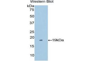 Western Blotting (WB) image for anti-Periostin (POSTN) (AA 500-630) antibody (ABIN1860279) (Periostin anticorps  (AA 500-630))