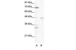 Image no. 1 for anti-Heat Shock Transcription Factor 4 (HSF4) (AA 172-221) antibody (ABIN203154) (HSF4 anticorps  (AA 172-221))