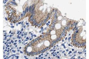 ABIN6268714 at 1/100 staining human colon tissue sections by IHC-P. (CXCL12 anticorps  (C-Term))