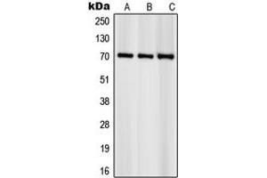 Western blot analysis of S6K1 (pS418) expression in NIH3T3 (A), HeLa (B), KNRK (C) whole cell lysates. (RPS6KB1 anticorps  (C-Term, pSer418))