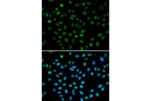 Immunofluorescence analysis of A549 cell using ATF6 antibody.