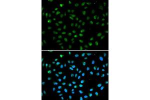 Immunofluorescence analysis of A549 cell using ATF6 antibody. (ATF6 anticorps  (AA 1-190))