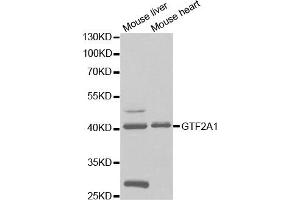 Western Blotting (WB) image for anti-General Transcription Factor IIA, 1, 19/37kDa (GTF2A1) antibody (ABIN1876533) (GTF2A1 anticorps)