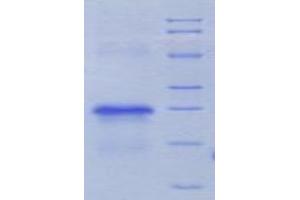 SDS-PAGE analysis of Rat uPAR Protein. (PLAUR Protéine)