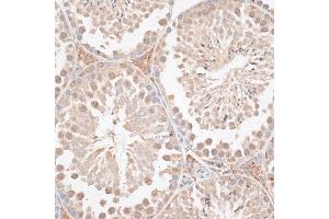 Immunohistochemistry of paraffin-embedded mouse testis using VEGF Receptor 2 antibody (ABIN6132247, ABIN6142816, ABIN6142819 and ABIN6215074) at dilution of 1:100 (40x lens).