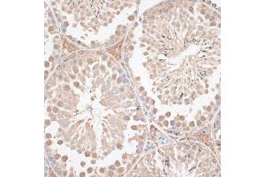 Immunohistochemistry of paraffin-embedded mouse testis using VEGF Receptor 2 antibody (ABIN6132247, ABIN6142816, ABIN6142819 and ABIN6215074) at dilution of 1:100 (40x lens). (VEGFR2/CD309 anticorps  (AA 20-200))