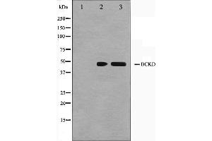 Western blot analysis on Jurkat and K562 cell lysate using BCKD Antibody. (BCKDK anticorps  (N-Term))