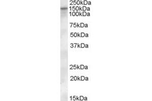 Western Blotting (WB) image for anti-Solute Carrier Family 12 (Potassium-Chloride Transporter) Member 4 (SLC12A4) (Internal Region) antibody (ABIN2465865)