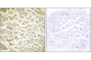 Immunohistochemistry analysis of paraffin-embedded human heart tissue, using Collagen XIV alpha1 Antibody. (COL14A1 anticorps  (AA 71-120))