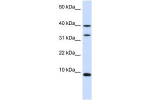 DBI antibody used at 1 ug/ml to detect target protein. (Diazepam Binding Inhibitor anticorps)
