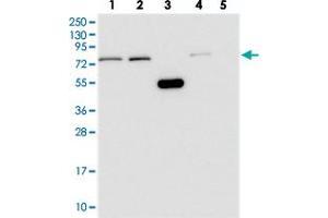 Western blot analysis of Lane 1: RT-4, Lane 2: U-251 MG, Lane 3: Human Plasma, Lane 4: Liver, Lane 5: Tonsil with WDR35 polyclonal antibody . (WDR35 anticorps)