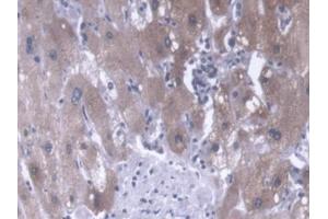 DAB staining on IHC-P; Samples: Human Liver Tissue