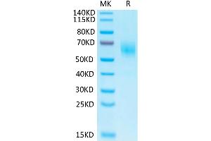Biotinylated Human IL-1 Rrp2 on Tris-Bis PAGE under reduced condition.