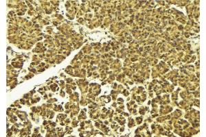 ABIN6268834 at 1/100 staining Mouse pancreas tissue by IHC-P.