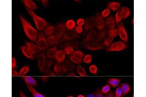 Immunofluorescence analysis of HeLa cells using VDAC3 Polyclonal Antibody at dilution of 1:100 (40x lens). (VDAC3 anticorps)