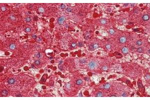Detection of FE in Human Liver Tissue using Polyclonal Antibody to Ferritin (FE) (Ferritin anticorps)