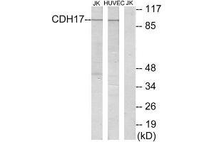 Western Blotting (WB) image for anti-LI Cadherin (Internal Region) antibody (ABIN1850218) (LI Cadherin anticorps  (Internal Region))
