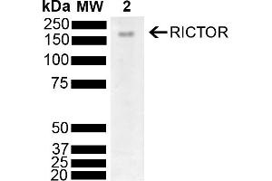 Western blot analysis of Mouse Brain showing detection of 192 kDa RICTOR protein using Rabbit Anti-RICTOR Polyclonal Antibody (ABIN5696206). (RICTOR anticorps  (AA 1060-1160) (PerCP))