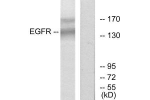 Western Blotting (WB) image for anti-Epidermal Growth Factor Receptor (EGFR) (Tyr1172) antibody (ABIN1848098) (EGFR anticorps  (Tyr1172))
