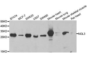 Western blot analysis of extracts of various cell lines, using NOL3 antibody. (NOL3 anticorps  (AA 1-208))