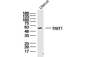 Mouse uterus lysates probed with TRIT1 Polyclonal Antibody, Unconjugated  at 1:300 dilution and 4˚C overnight incubation.