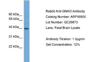 WB Suggested Anti-GNAI3  Antibody Titration: 0. (GNAI3 anticorps  (N-Term))
