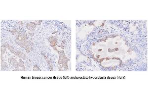 Immunohistochemistry (IHC) image for anti-Six Transmembrane Epithelial Antigen of The Prostate 1 (STEAP1) (AA 1-70), (N-Term) antibody (ABIN317568) (STEAP1 anticorps  (N-Term))