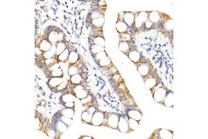 Immunohistochemistry of paraffin-embedded human small intestine using NDUF Rabbit mAb (ABIN7268797) at dilution of 1:50 (40x lens).