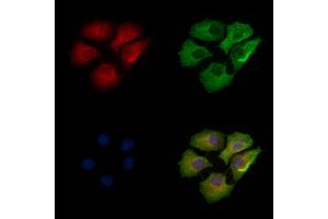 ABIN6256691 and ABIN6267080 staining Hela cells(heat shock treatment) by IF/ICC.