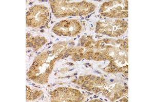 Immunohistochemistry of paraffin-embedded human kidney using  antibody (ABIN6127359, ABIN6136867, ABIN6136868 and ABIN6222919) at dilution of 1:100 (40x lens). (ANAPC5 anticorps  (AA 1-250))
