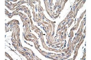 PDK4 antibody was used for immunohistochemistry at a concentration of 4-8 ug/ml to stain Skeletal muscle cells (arrows) in Human Muscle.