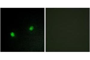 Immunofluorescence analysis of HeLa cells, using ZNF7 Antibody. (ZNF7 anticorps  (AA 41-90))