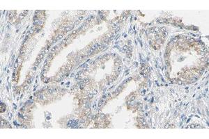 ABIN6276592 at 1/100 staining Human prostate tissue by IHC-P. (K-RAS anticorps  (C-Term))